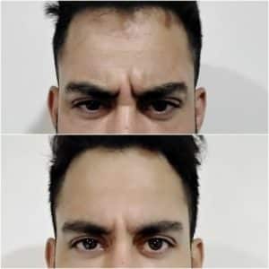 como-lucir-joven-en-verano